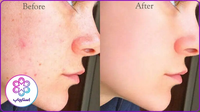 بهترین برنامه روتوش عکس اندروید