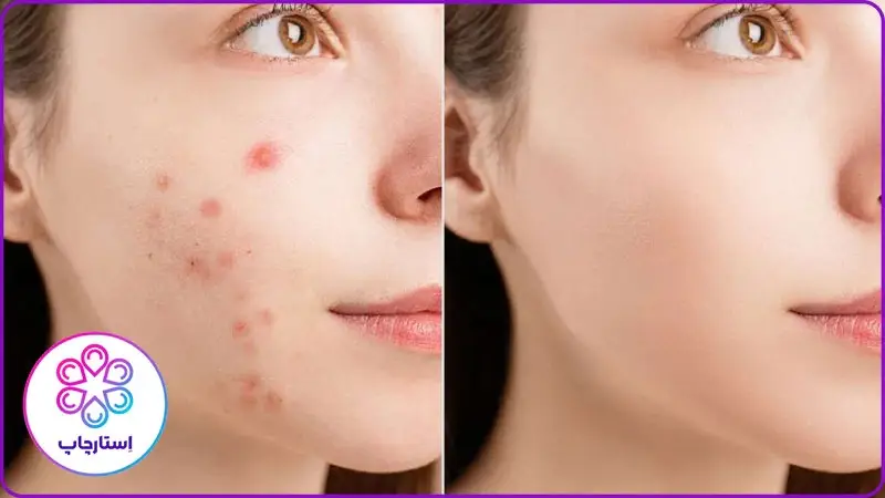 بهترین برنامه روتوش عکس آیفون