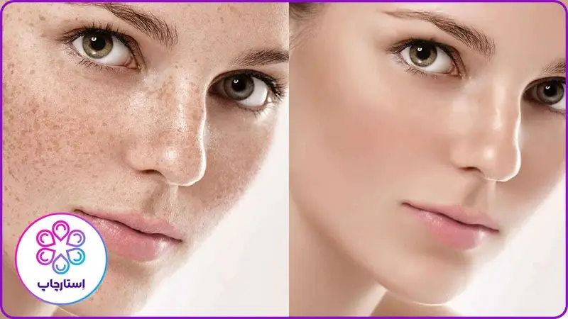 بهترین نرم افزار های مناسب روتوش