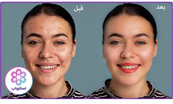 بهترین نرم افزار های مناسب روتوش (اندروید+آیفون+ویندوز)