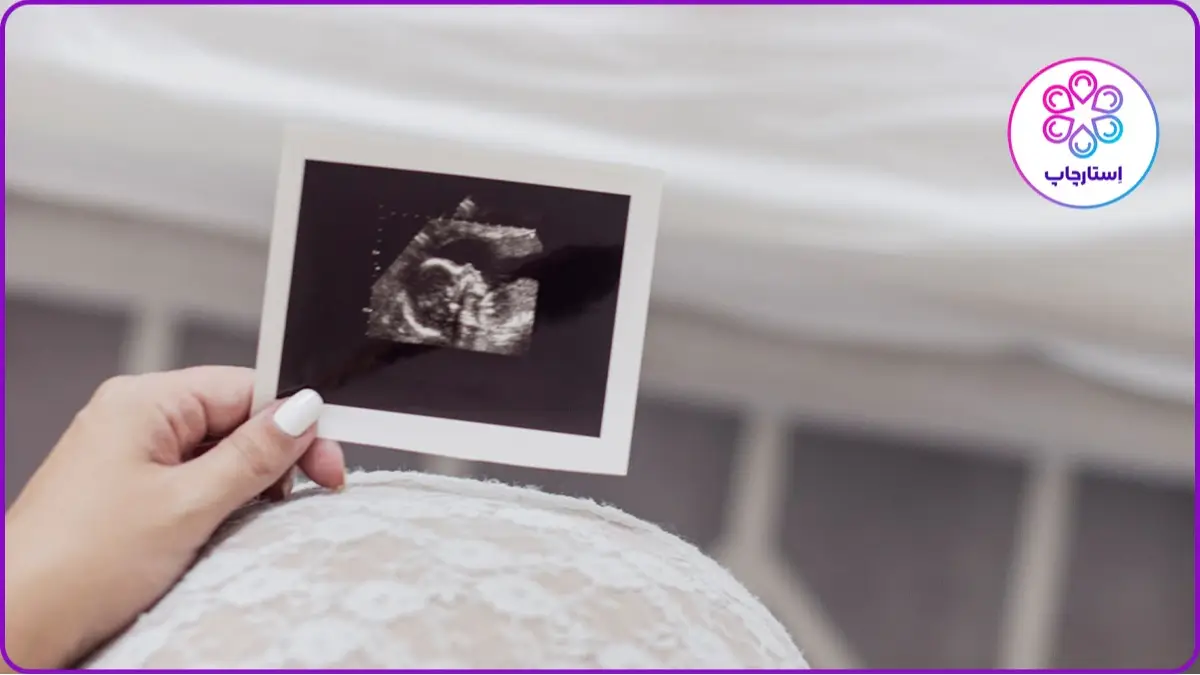ایده عکاسی بارداری با عکس سونوگرافی