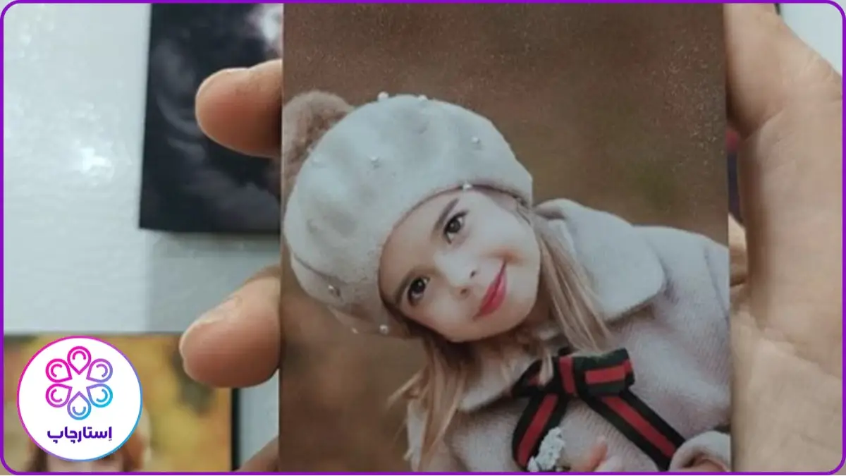 عکس های روی شاسی تا چندسال می ماند؟